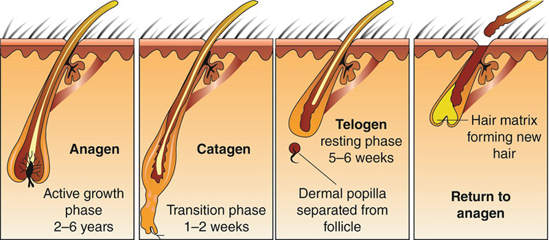 Role of DHT in hair loss
